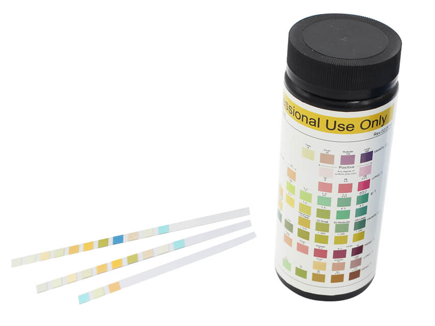 Urinalysis Strips