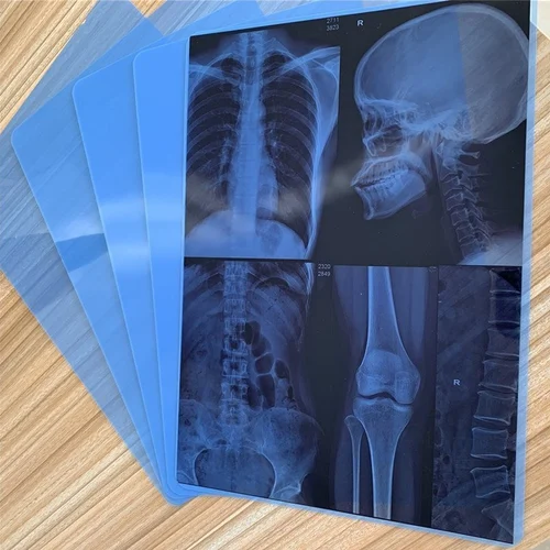 X-ray Films
